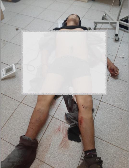 Joven herido en Ercilla 3