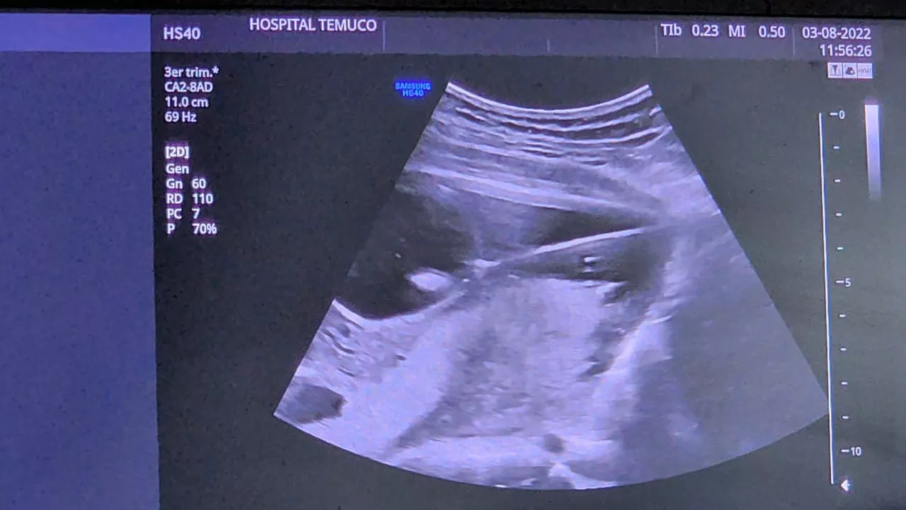 3aa59f4b-9eae-47ce-a816-86d22ed433f2