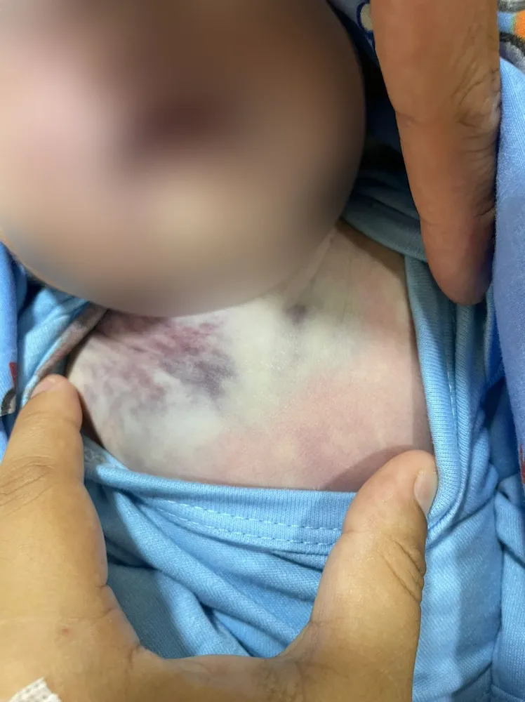 Bebe Fallecido en hospital Temuco con moretones - publicada con autorizacion de la familia