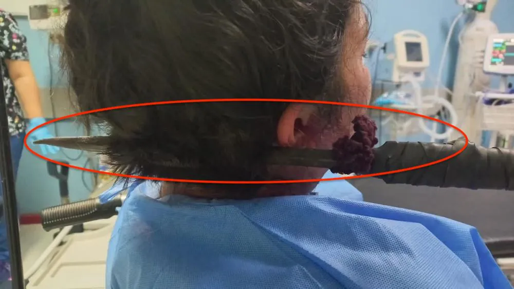 Mujer con lanza de metal en el cuello