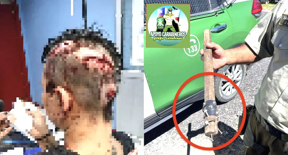 Ataque a mujer con palo con clavos