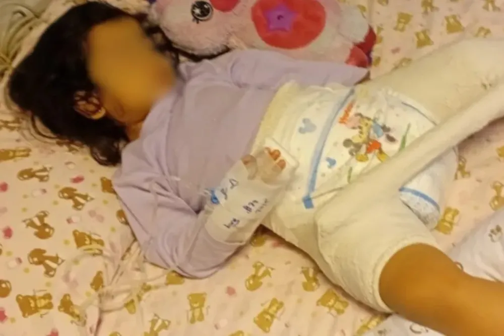 Niña de fracturo el femur en jardin de Integra