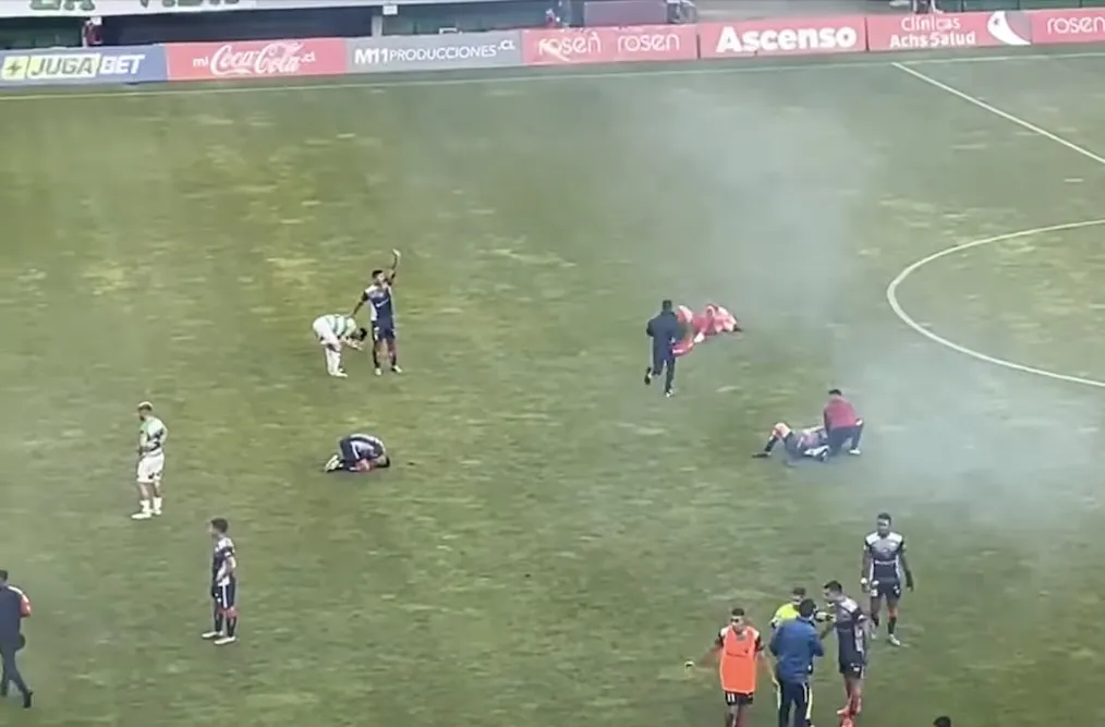 Jugadores Lesionados por Bengalas Deportes Temuco